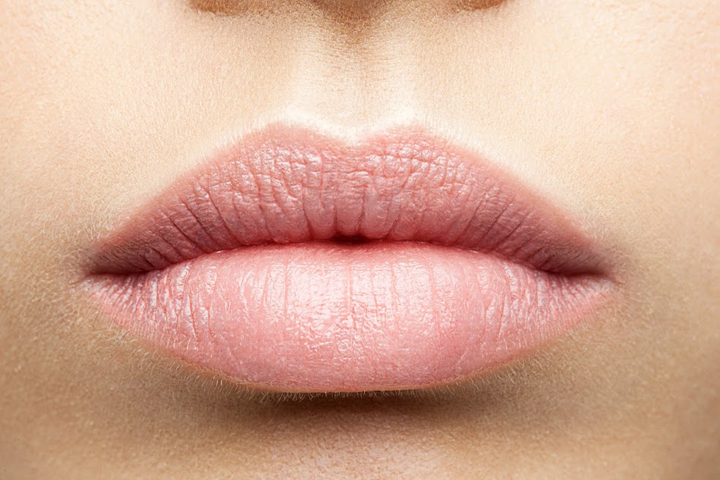 Dermal Fillers are used to achieve beautiful, plump lips at the White Mountain Med Spa & Ketamine as shown here.